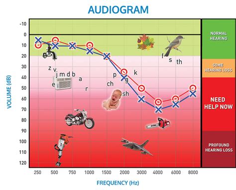 Understanding your Hearing Test Results .